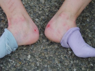 2011.05.23 Chasseralskate